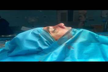 عمل جراحی زیبایی سپتو رینوپلاستی در بیمارستان امام حسین (ع) بهارستان انجام شد